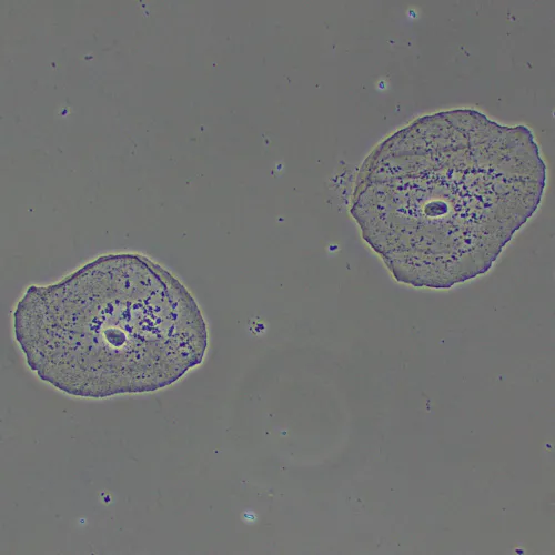 a fotón:  MAGUS PH2 fáziskontraszt eszköz,  15