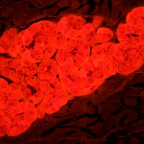 a képen:  MAGUS Lum 450L fluoreszcens mikroszkóp,  25