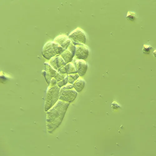 a képen:  MAGUS HCM360 eszköz Hoffman modulációs kontraszt használatához, objektív készlettel,  14