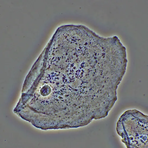 a fotón:  MAGUS PH2 fáziskontraszt eszköz,  16