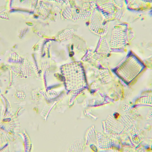 a fotón:  MAGUS Bio D290T LCD biológiai digitális mikroszkóp,  32