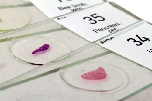 a fényképen:  Levenhuk N80 NG „Láss mindent!” tárgylemezkészlet,  6