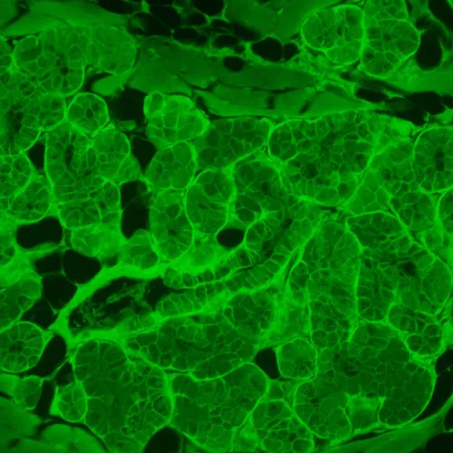 a képen:  MAGUS Lum V500L fluoreszcens fordított mikroszkóp,  17
