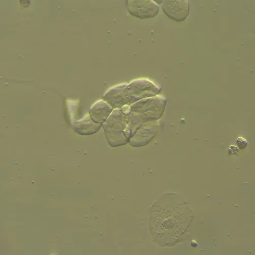 a képen:  MAGUS HCM360 eszköz Hoffman modulációs kontraszt használatához, objektív készlettel,  13